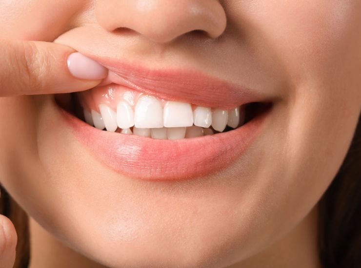 Acqua e limone effetto sui denti