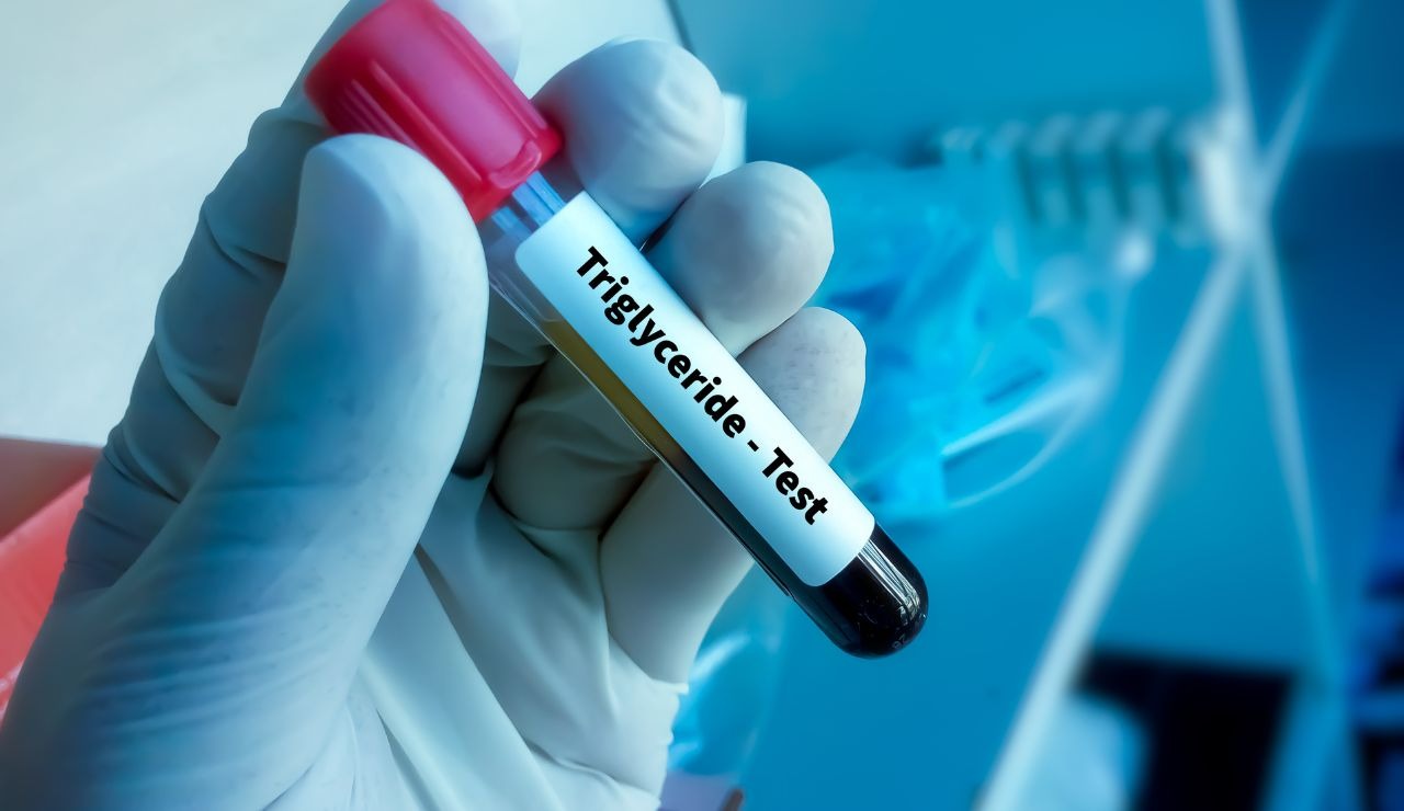 Cibo che abbassa i trigliceridi